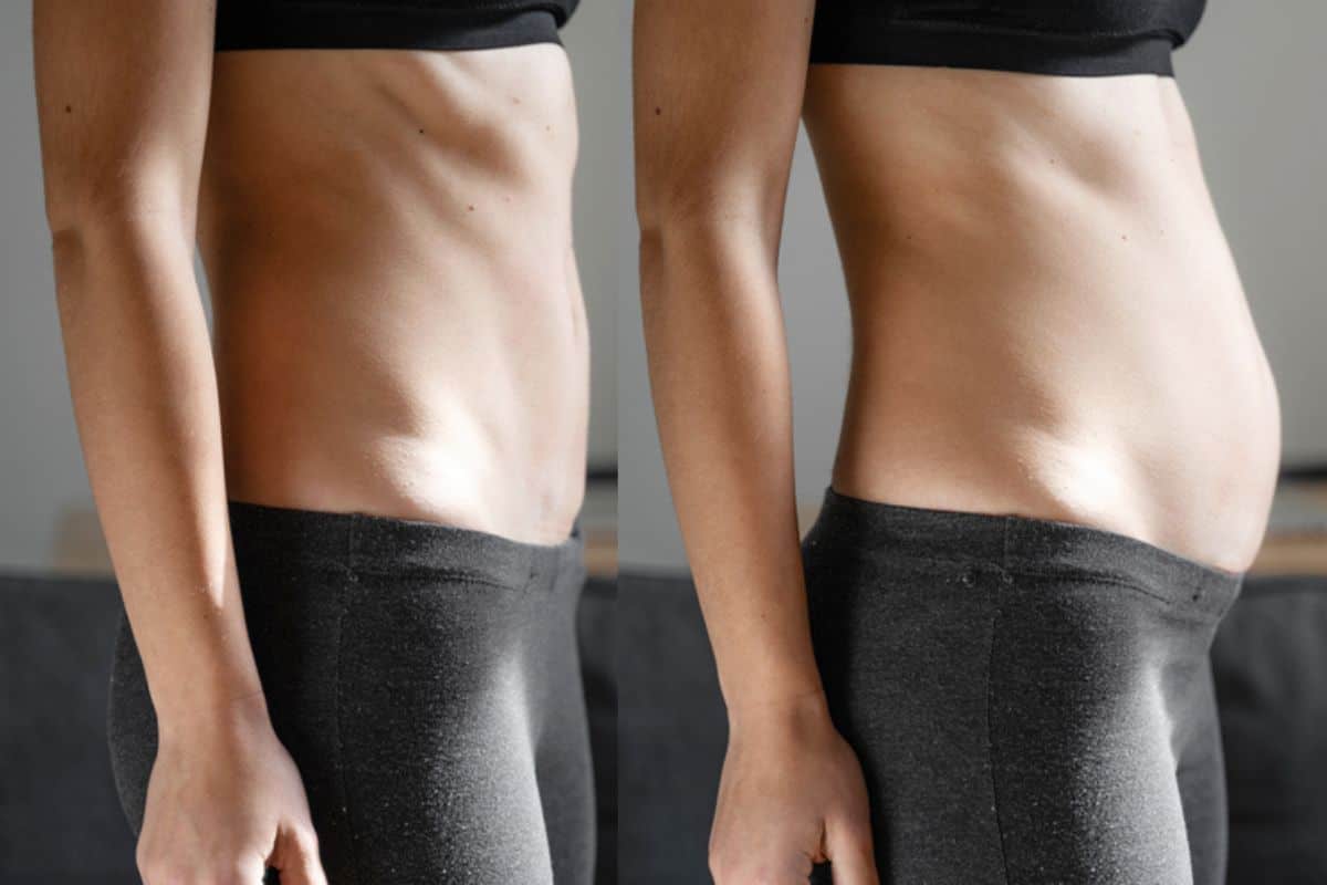 How long does diastasis recti take to improve Worcestershire?