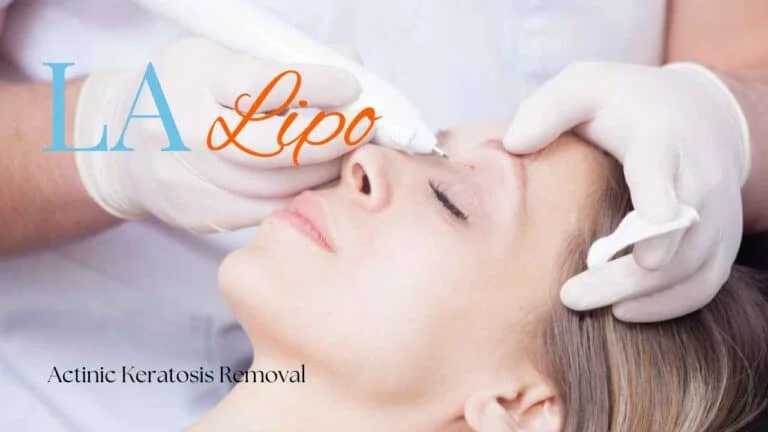 Woman receiving Actinic Keratosis Removal Treatment Worcestershire