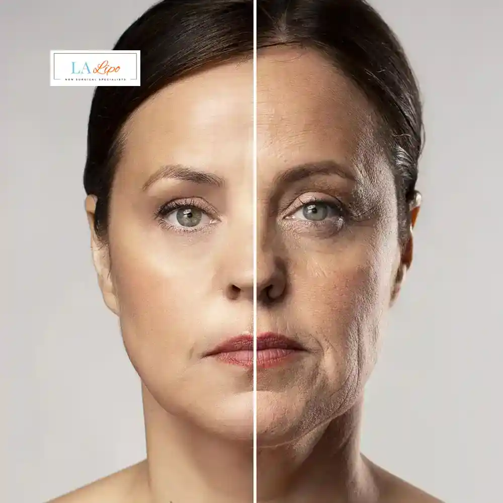 How Can You Tell If Non-Surgical Skin Tightening Is Right for You Worcestershire?
