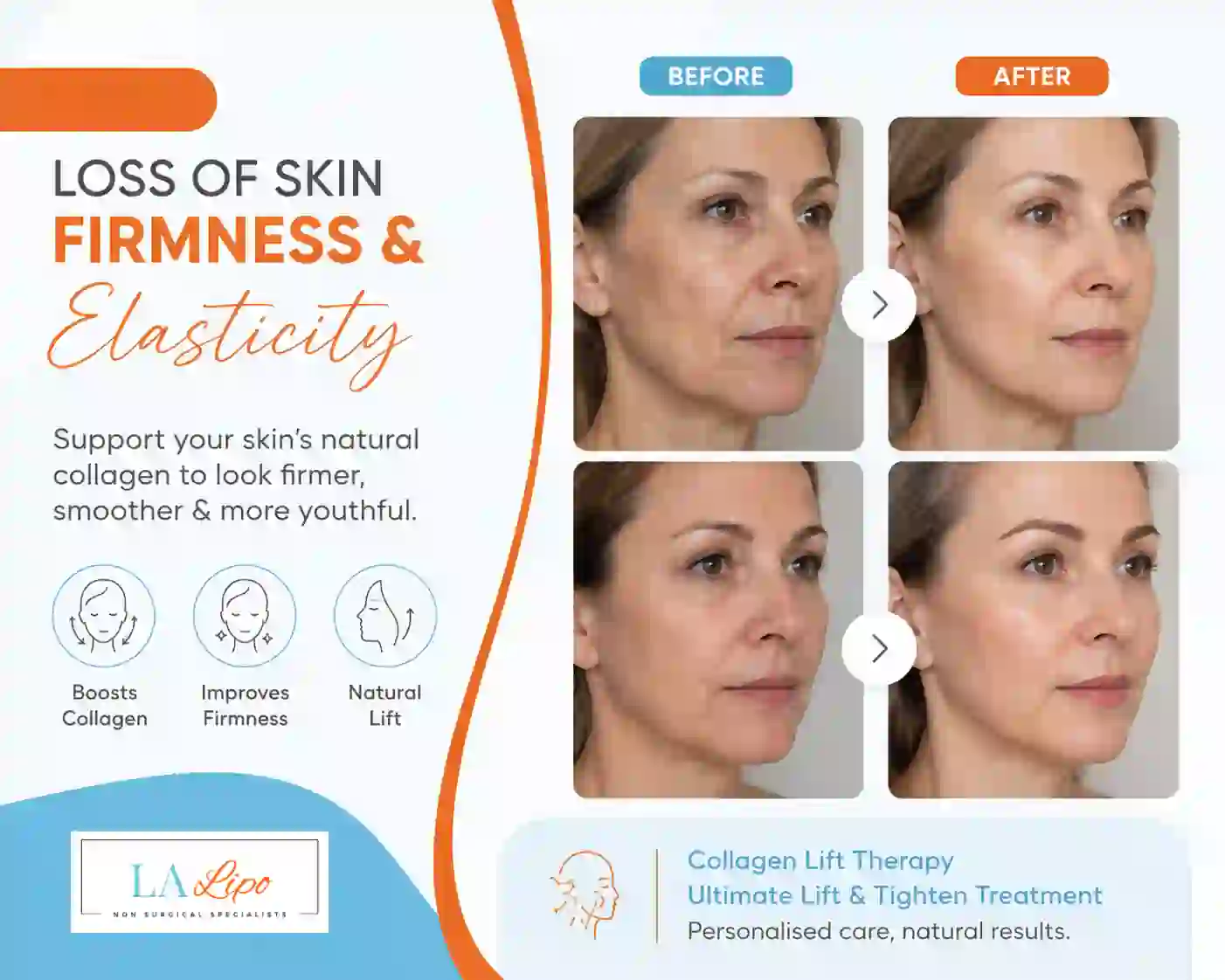 Sign #7: Loss of Skin Firmness and Elasticity Worcestershire