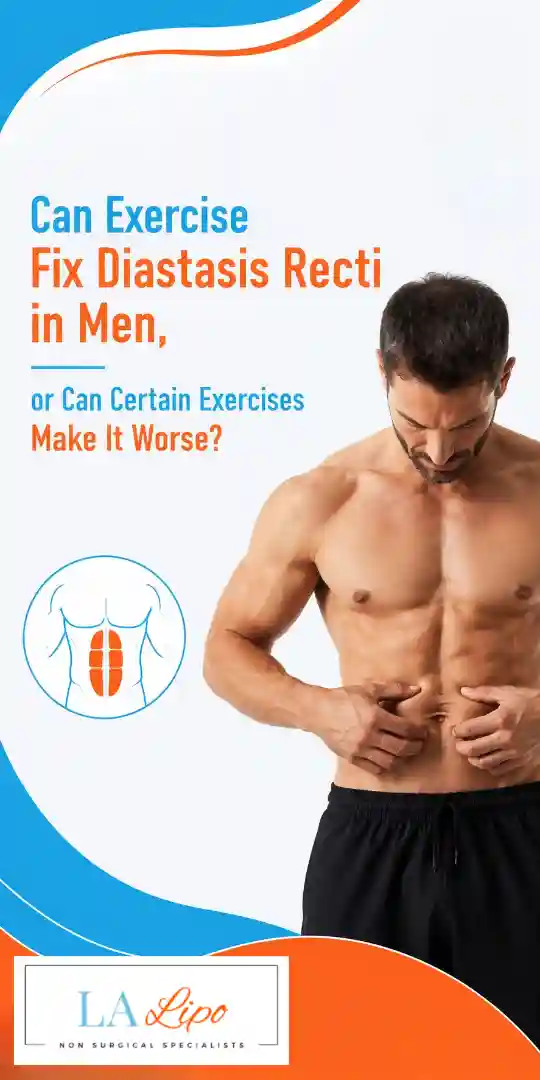 Can Exercise Fix Diastasis Recti in Men, or Can Certain Exercises Make It Worse Worcestershire?
